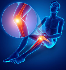 3d Illustration of Male feeling Knee pain