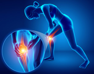 3d Illustration of Female feeling Knee pain