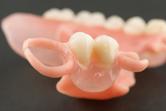 large image of a modern denture