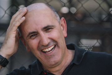 Bald man shows his funny head.