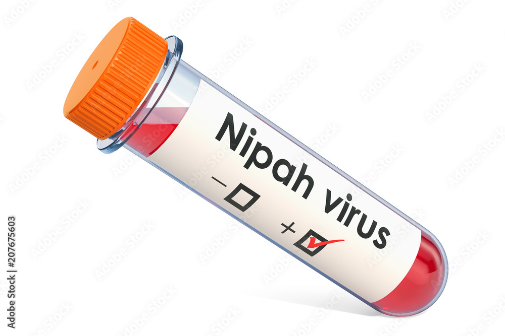 Poster test tube with blood sample positive with nipah virus, 3d rendering