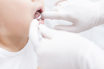 小児矯正マウスピースで健康な歯並びを育てよう【赤羽歯科・矯正歯科】|赤羽橋歯科・矯正歯科