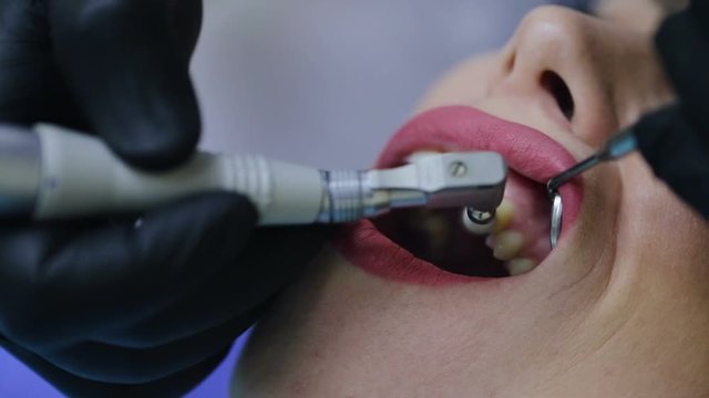The dentist treats the teeth to the patient. Slow motion