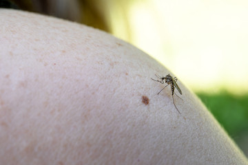 Close up a Mosquito sucking human blood. Skin with moles and texture