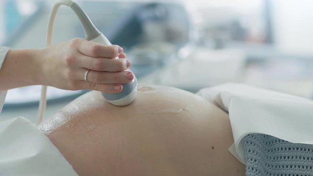 In the Hospital, Close-up Shot of the Doctor Doing Ultrasound / Sonogram Scan to a Pregnant Woman. Obstetrician Moving Transducer on the Belly of the Future Mother.