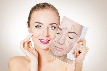 portrait of woman with clean skin holding portrait with pimpled skin
