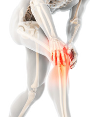 Knee painful - skeleton x-ray.