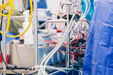 Total Artificial Heart connected in surgery to TAH pump that is surgically installed to provide...
