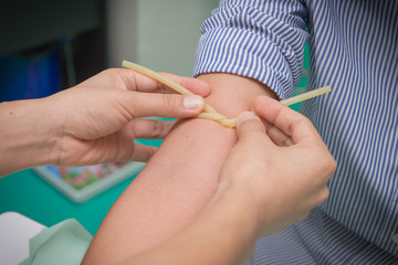 Nurse prepare collecting a blood from patient in hospital