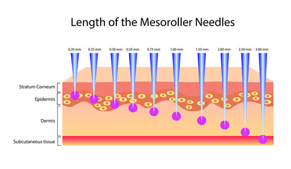 Length of the mesoroller needles, Vector illustration