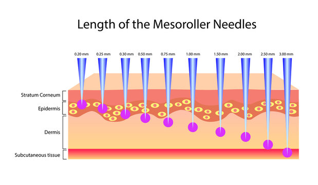Length of the mesoroller needles, Vector illustration