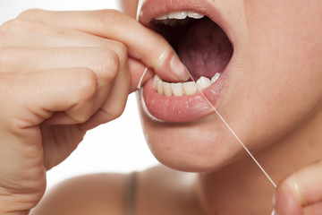  young woman cleans her teeth with a dental floss