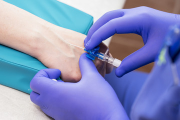 medical nurse with blue latex gloves inputs catheter to vein patient for drip of chemotherapy or...