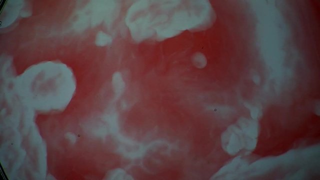 The Belousov&ndash;Zhabotinsky reaction, also known as the BZ reaction, forms concentric patterns in a chemical solution.