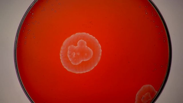 The Belousov&ndash;Zhabotinsky reaction, also known as the BZ reaction, forms concentric patterns in a chemical solution.