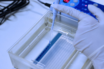 Molecular technique Agarose gel elctrophoresis for DNA sample