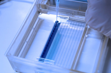 Obraz premium Molecular technique Agarose gel elctrophoresis for DNA sample