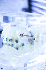 Dental teeth brackets aligners