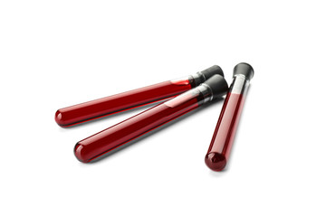 Test tubes with blood samples on white background