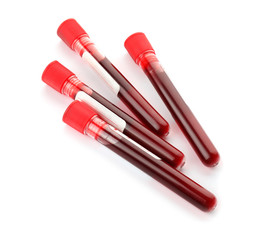 Test tubes with blood samples on white background