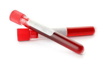 Test tubes with blood samples on white background