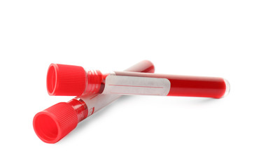 Test tubes with blood samples on white background