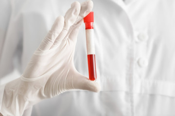 Woman holding test tube with blood sample, closeup