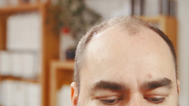 Man with hair loss problems close-up 4K. Long shot dolly slide of mand top of the head in focus while looking down showing bald parts of the head.