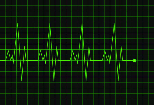 Cardiogram heartbeat. Abstract green line electrocardiogram on dark green grid. Medical wave chart. Vector background