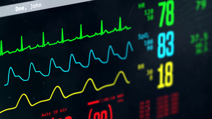 Patient's condition monitored in intensive care unit, screen with vital signs. 3D illustration