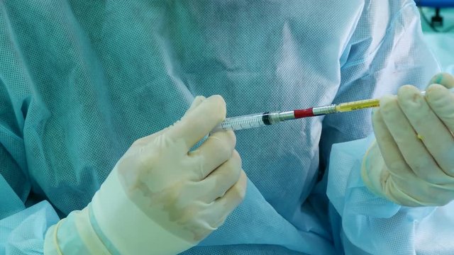 The doctor fills the syringe with diluted human fat with medications before pumping into the face of the patient