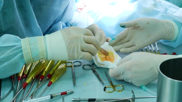 The doctor cleans the human fat collected in the thigh of the patient, on gauze during a plastic surgery