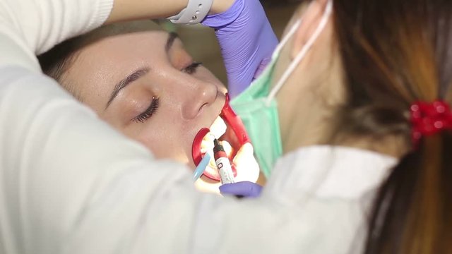 Young woman with an expander in mouth at the dental clinic. Application of protective whitening gel to the teeth.
