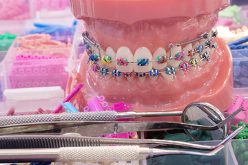 orthodontic model and dentist tool - demonstration teeth model of varities of orthodontic bracket or brace