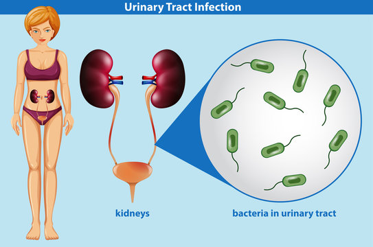 Human Anatomy Of Urinary Tract Infection