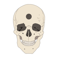 Human realistic skull with a hole. Trepanation, ancient surgery. White background. Flat vector illustration.