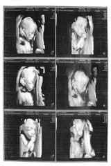 Child on an ultrasound picture background
