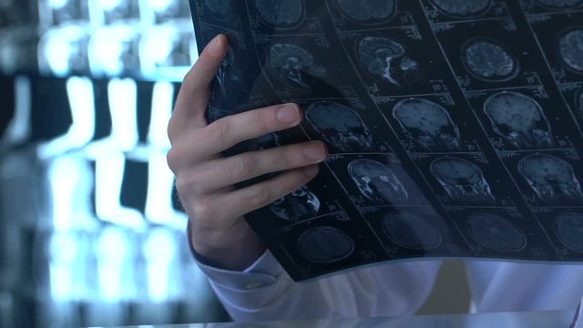 Medic intern analyzing brain x-ray image, students anatomy research, neurology