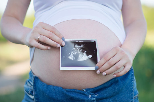 young pregnant girl holding a picture of an ultrasound