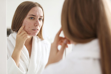 Obraz na płótnie Canvas Young woman with acne problem near mirror in bathroom