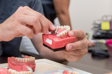 Zahnprothesen - Zahnersatz