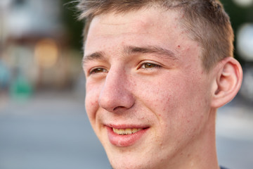 Obraz premium A young happy guy with problem skin having fun while walking around the summer city.