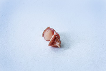 Fibroma, mole close-up in a cut on a white background