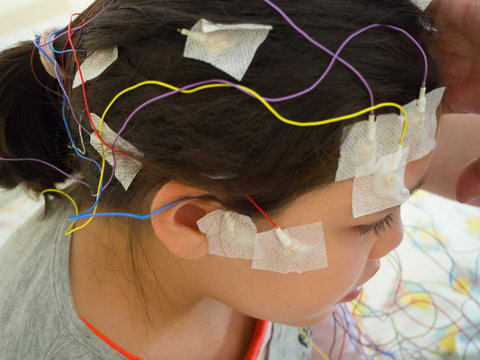 Girl with EEG electrodes attached to her head