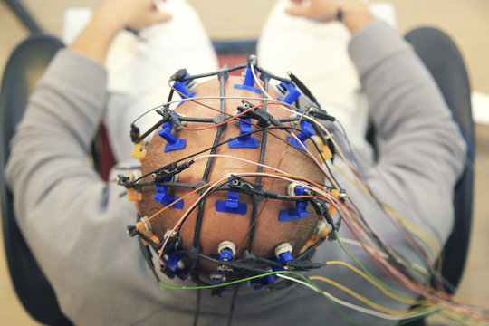 Electroencephalography.