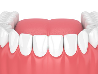 3d render of jaw model with teeth over white