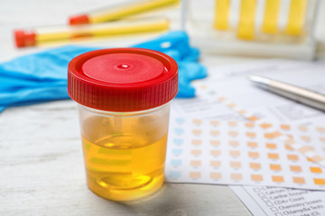 Jar with urine sample on table. Urology concept