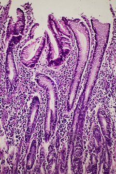 human stomach gastric mucosa intestinal metaplasia