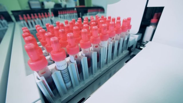 Many bottles with blood, close up. Special machine tests blood samples in tubes at a clinic.