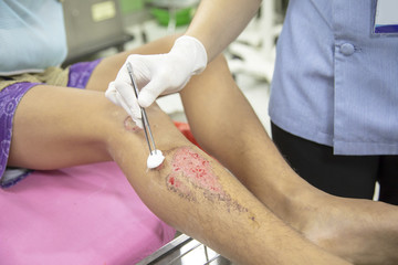 wound